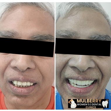 Elderly Dental Care Testimonial 12