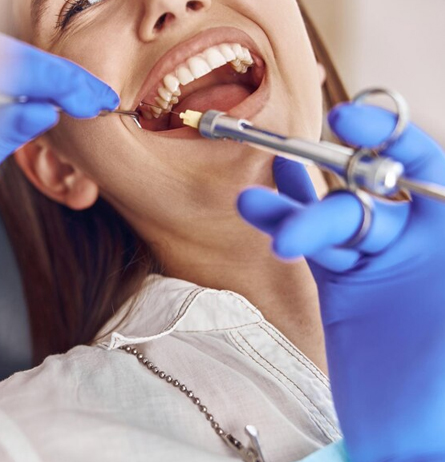 Laser Teeth Whitening Experts