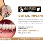 Dental Implants