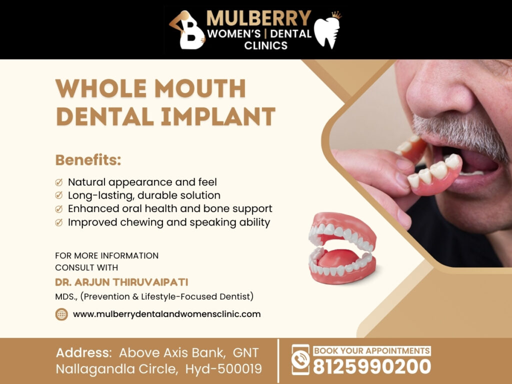 Whole Mouth Dental Implant in Hyderabad | Best Implantologist