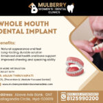 Whole Mouth Dental Implant in Hyderabad | Best Implantologist